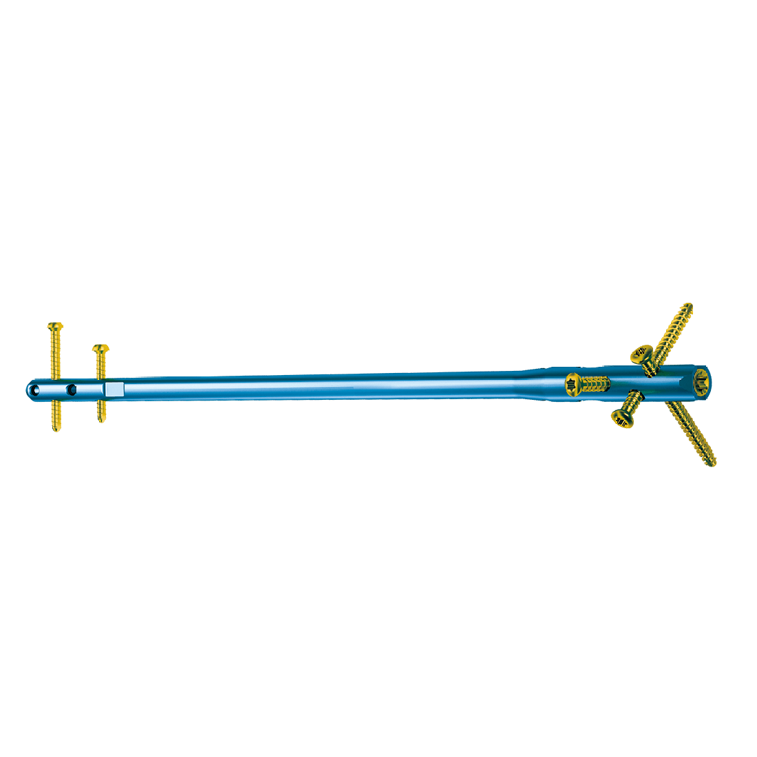 Interlocking Intramedullary Nails System