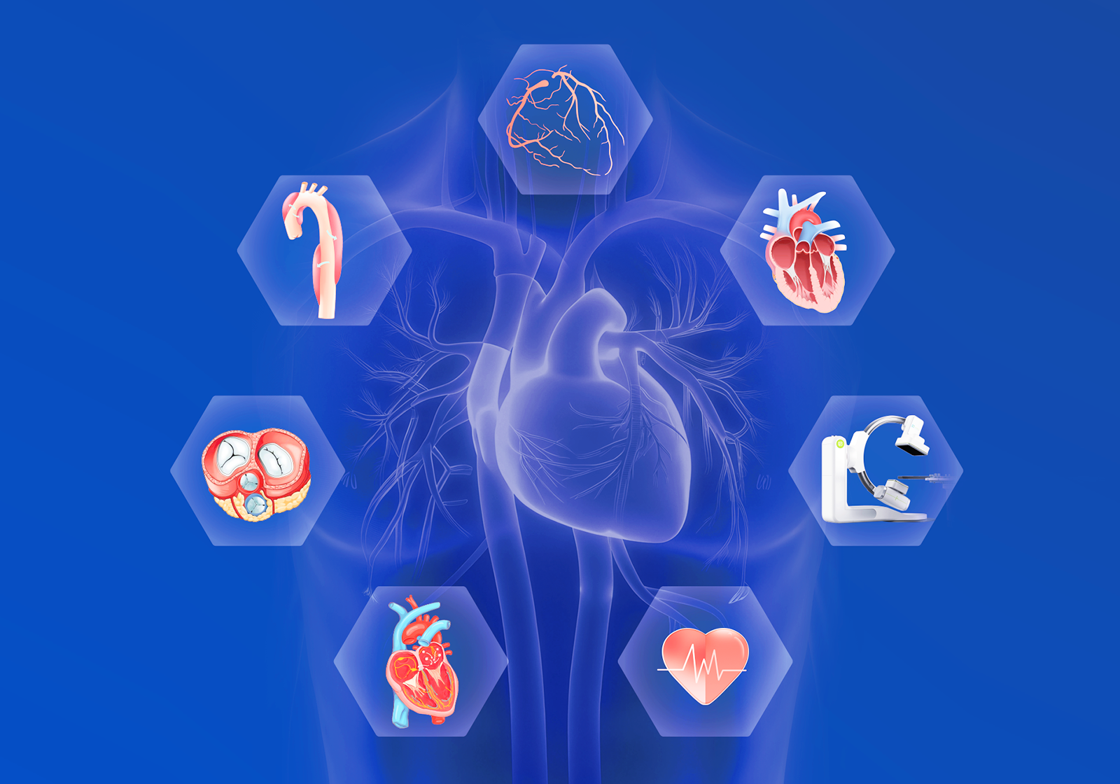 Coronary Calcification Lesion Treatment Solution