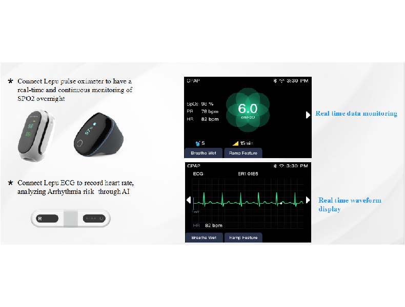 r datafanyifanyiVantagem Suporta dispositivos portteis Bluetooth, reduz as restries do cabo Suporta ...